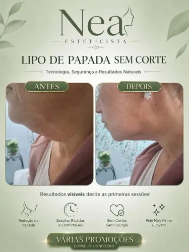 Jato de plasma com laser