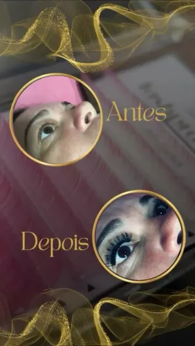 Cílios