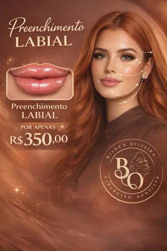 Preenchimento Labial 