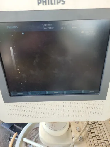 Maquina de ultrasom portatil