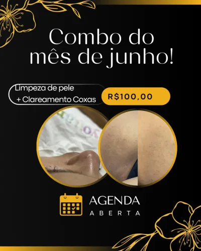 Limpeza de pele + Clareamento combo