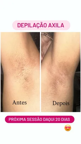 Depilação CERA FEMININA 