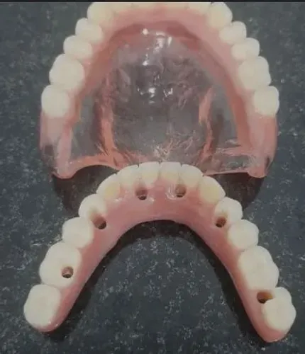 PRÓTESE DENTÁRIA 