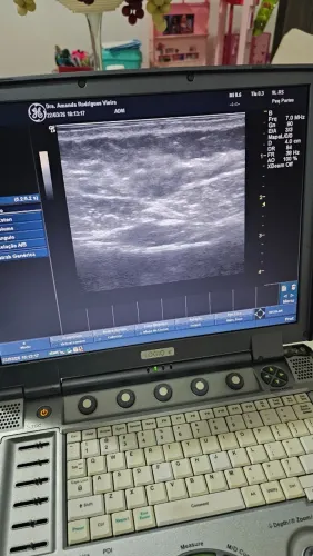 Ultrassom Portátil GE