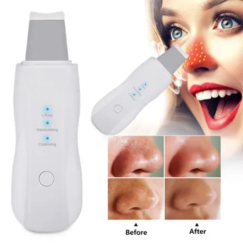 Aparelho Peeling Ultrassônico Removedor Cravos Limpeza Pele Acne Capilar Estética z036