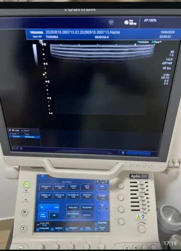 Vendo Ultrassom