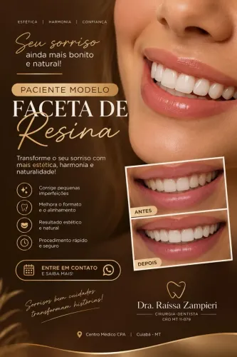 Facetas de resina