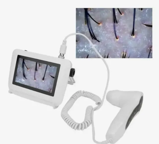 Dermatoscópio Analisador De Pele E Couro Cabeludo Profissional