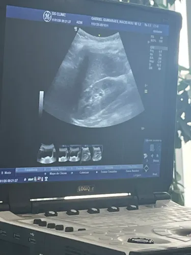 Ultrassom logique GE portátil