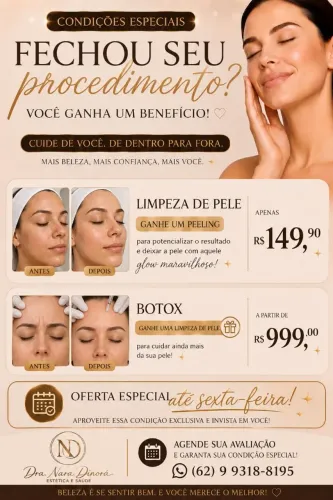 Botox 