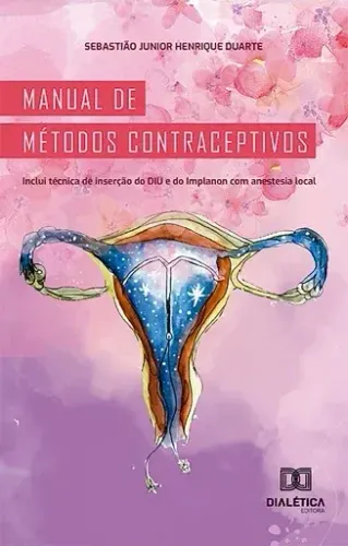 Manual de métodos contraceptivos: inclui técnica de inserção do DIU e do Implanon com anes