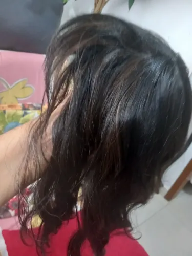 Topo capilar
