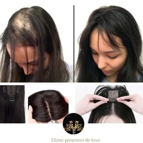 Topos de cabelo humano para pequenas falhas capilar.