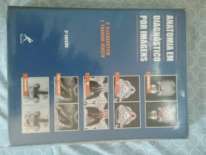 Anatomia em Diagnóstico por Imagens -2° edicao 2ª Edição