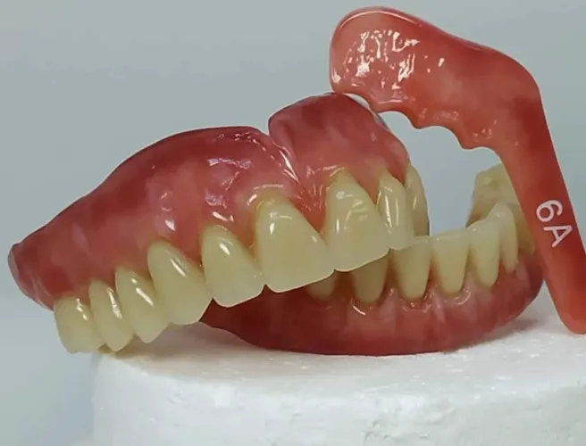 Prótese dentária 