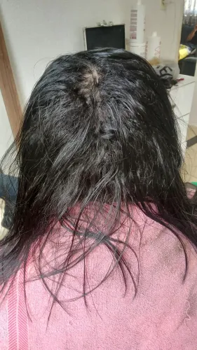Selagem Led terapia a domicílio