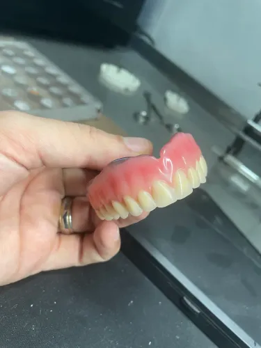 Prótese dentária 