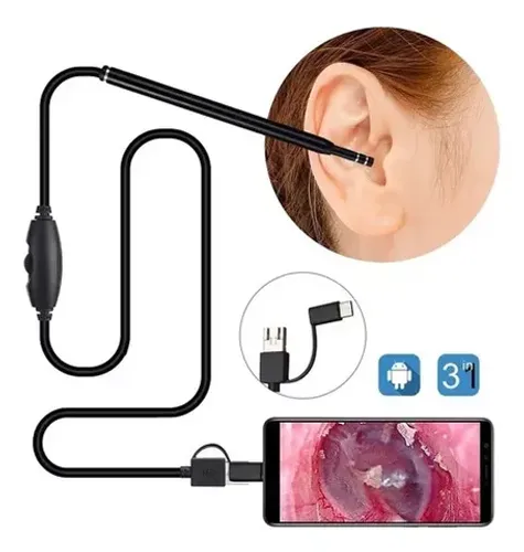 Câmera De Limpeza De Ouvido Endoscópica (Visual Earwax Clean Tool)