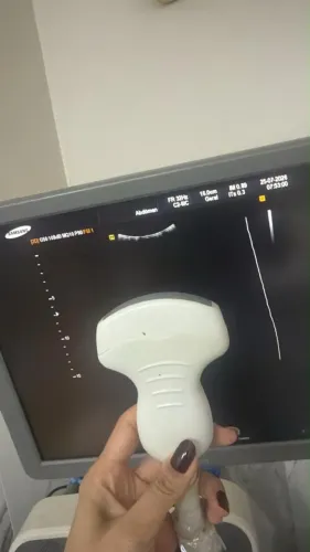 Máquina de USG com os 3 transdutores SAMSUNG