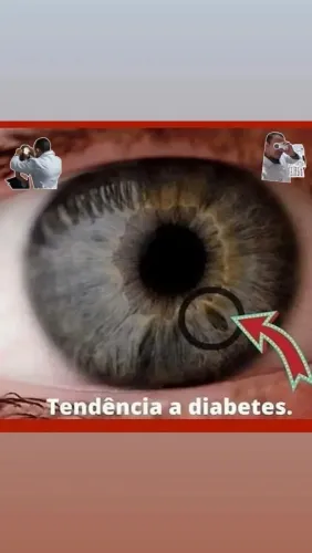 Avaliações através de terapias naturais: Iridologia e Naturopatia!