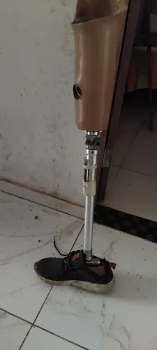 Perna mecânica