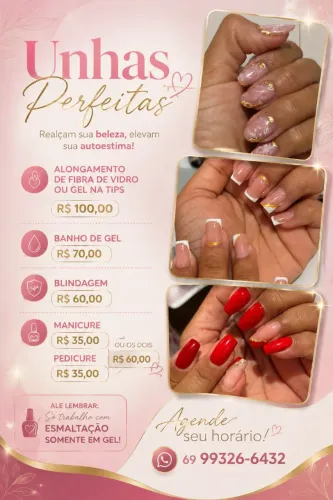 Unhas