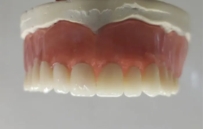 Prótese dentária