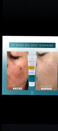 Creme Esfoliante para o Rosto - Renova a Pele em 15 Dias