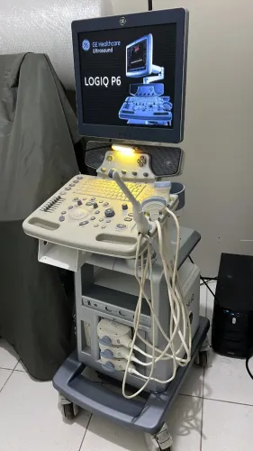 Ultrassom Color GE Logiq P6 Pro Ecografo Geral Color Doppler