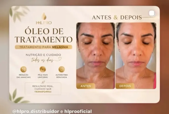 Óleo corporal 
