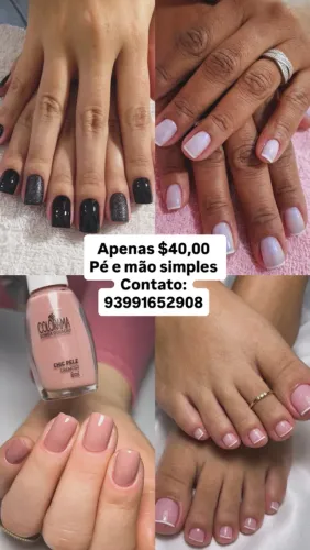 Unha