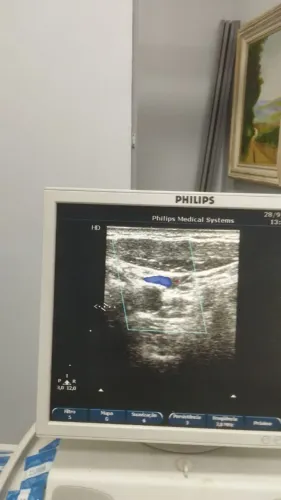 ULTRASSOM PHILIPS EXCELENTE P/VET