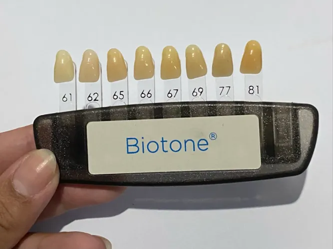 Escala de cores Biotone - Dentsply SIRONA 