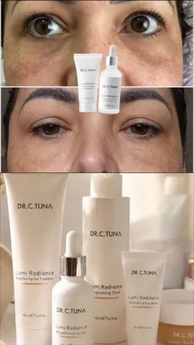 Sofre com rugas e linhas finas?Tenho oque vai te ajudar