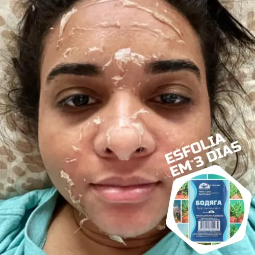 2 Peeling de Algas Marinhas + Calmante Pos