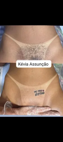 Epilação de virilha a domicílio
