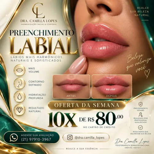 Preenchimento labial