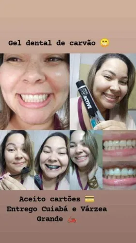 Gel dental de carvão ativo 