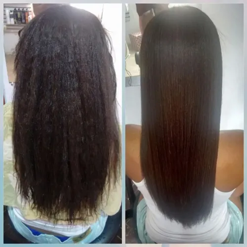 SELAGEM E BOTOX