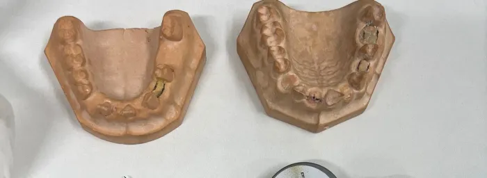 Modelo gesso para anatomia dental - odontologia