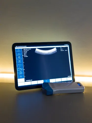 Ultrassom Portátil Mobissom
