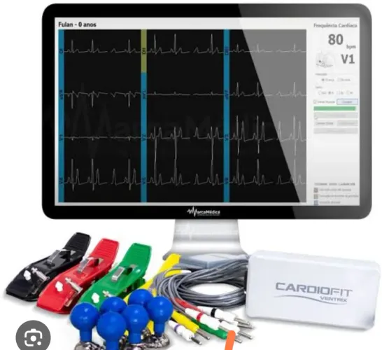 aparelho de ECG Cardiofit, ideal também para laudo a distância via telemedicina.tem Anvisa