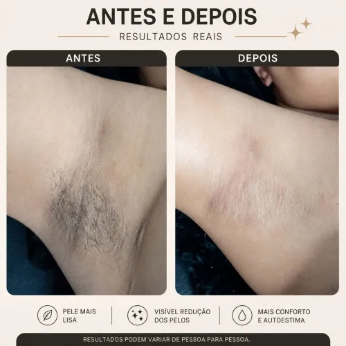 Depilação a cera, sou Carol de Mauá abc