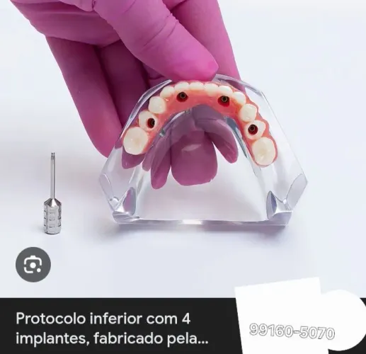 Dentista clínica geral/ implante dentario