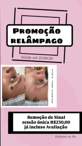 Estética Avançada JATO de PLASMA 