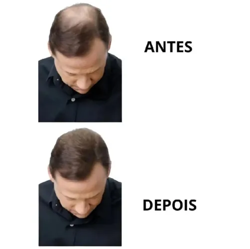 Fibra capilar 