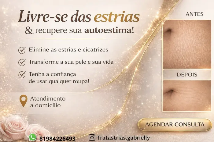 Tratamento de Estrias 