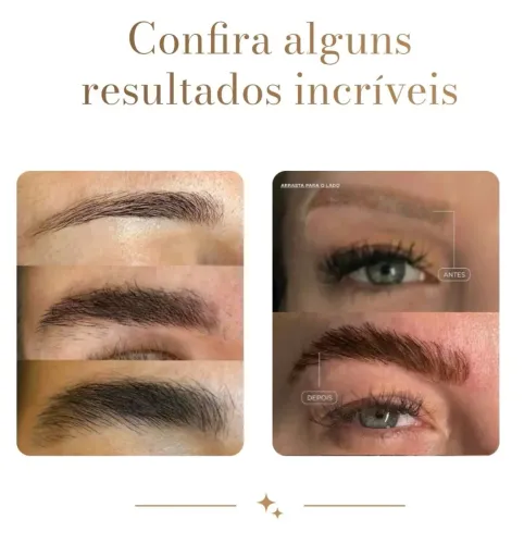 Despigmentação de sobrancelhas e tratamento com exossomos de crescimento