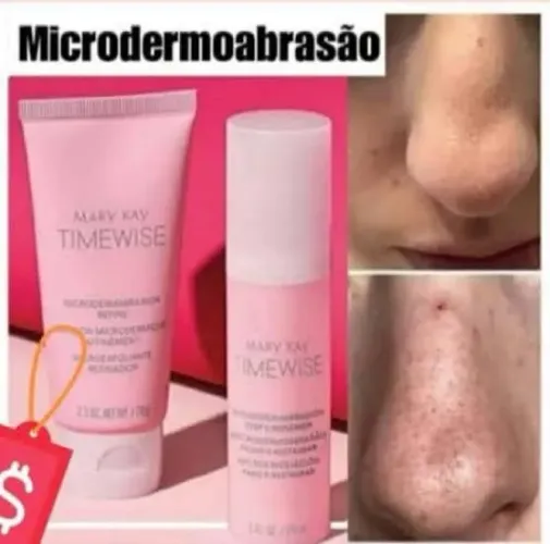 Microdermoabrasão Mary Kay Timewise