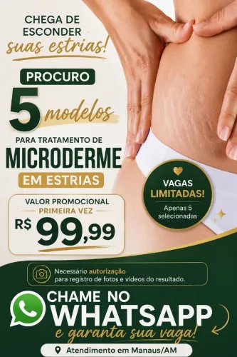 Estrias